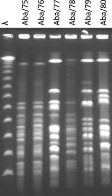 Pandrug-resistant Acinetobacter baumannii from different clones and regions in Mexico have a similar plasmid carrying the blaOXA-72 gene